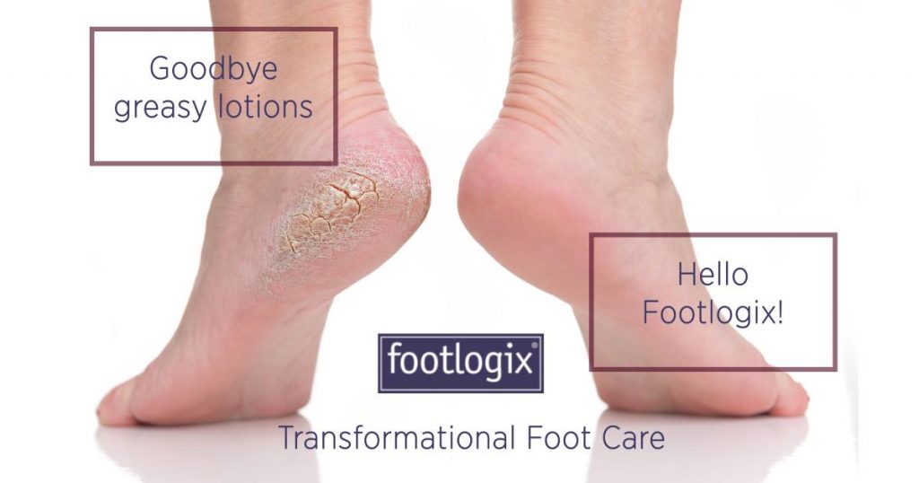 nieuwe-voetbehandeling-footlogix